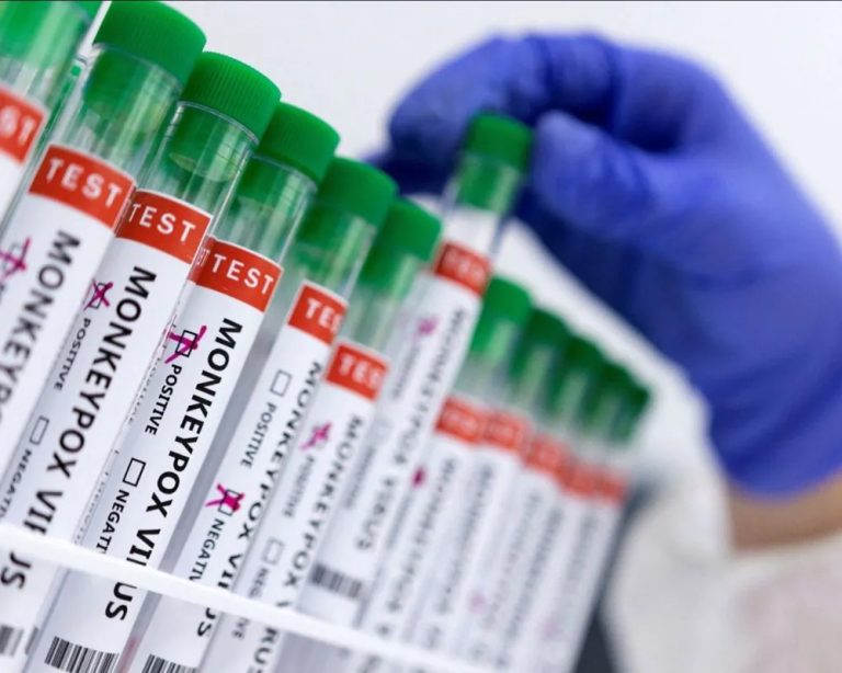 În Republica Moldova a fost confirmat al doilea caz de infectare cu variola maimuței