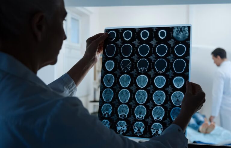 Premieră mondială. Un test de sânge poate detecta cu precizie cancerul cerebral „inaccesibil”